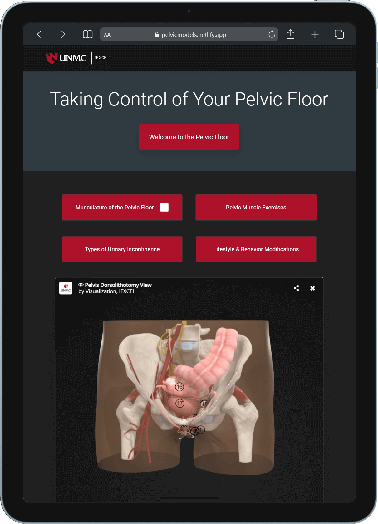 3D Pelvic Floor Patient Application